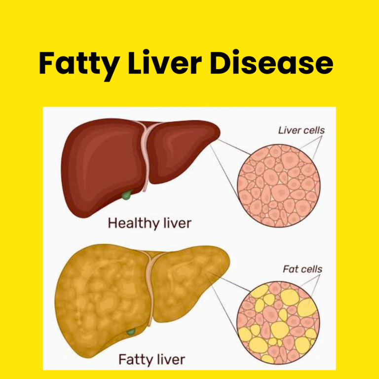 Fatty Liver Details